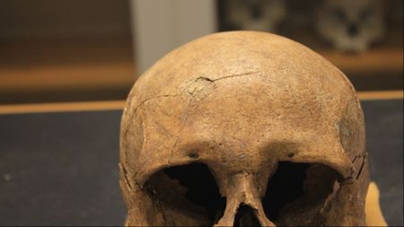 A skull with a crack in the forehead
